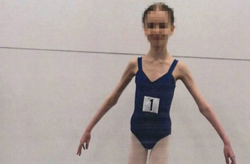 Важила всього 27 кілограмів: в Австралії батьки роками морили голодом доньку-балерину