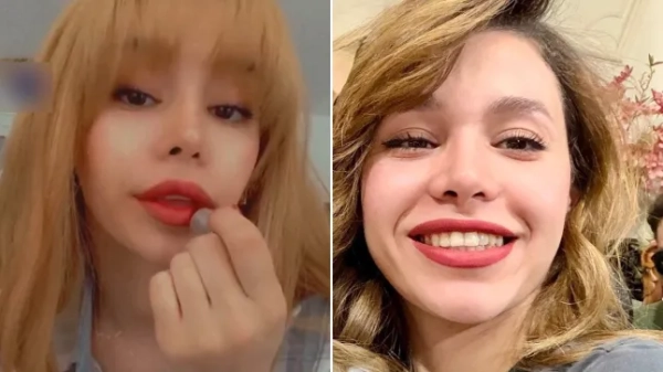 Рубіна Амінян, 23-річна студентка з Тегерана, отримала поранення в потилицю
