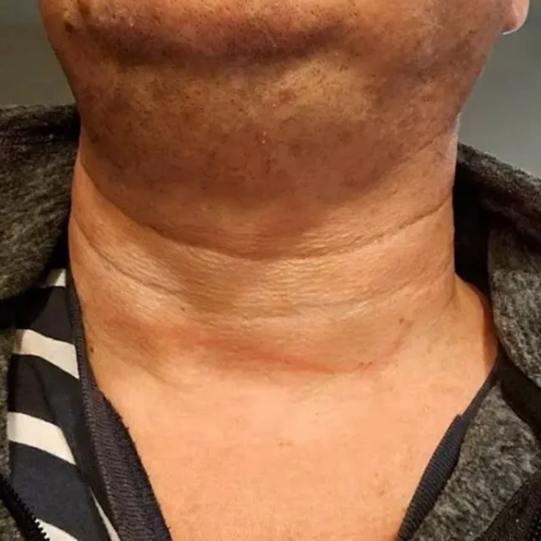 Інцидент стався в курортному готелі Sunrise Arabian Beach Resort у Шарм-ель-Шейху, Єгипет (Фото: Telegram)