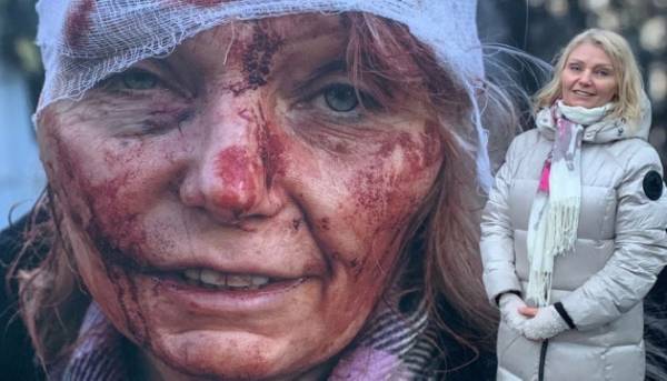 «В Україні я щаслива». Історія Олени Курило, яку назвали «першим обличчям війни»