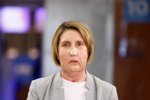 epa12699923 Кармен, перша людина у світі, якій зробили пересадку обличчя від евтаназованого донора, позує в лікарні Валь-д'Еброн у Барселоні, Іспанія, 2 лютого 2026 року. EPA/Квіке Гарсія