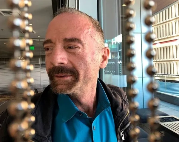 Чоловік вилікувався від ВІЛ завдяки трансплантації стовбурових клітин від свого брата за допомогою першої у своєму роді процедури. Тімоті Рей Браун, також відомий як «берлінський пацієнт», був першою людиною, яку вилікували від ВІЛ та раку за допомогою трансплантації стовбурових клітин у 2008 році. На фото вище він у 2019 році, помер у 2020 році. Фото: AP