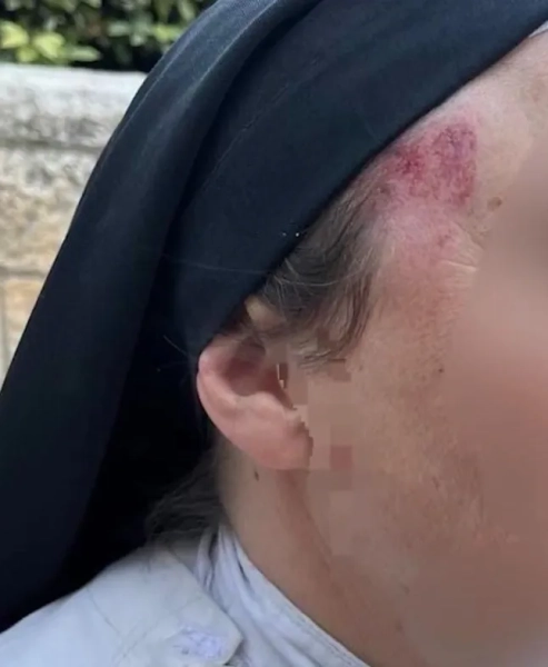 Черниця раптово штовхнулася та вдарила ногою в голову, прогулюючись Єрусалимом