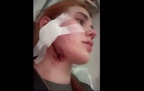 Напад на українців у Польщі – генконсульство України вже відреагувало&hellip;