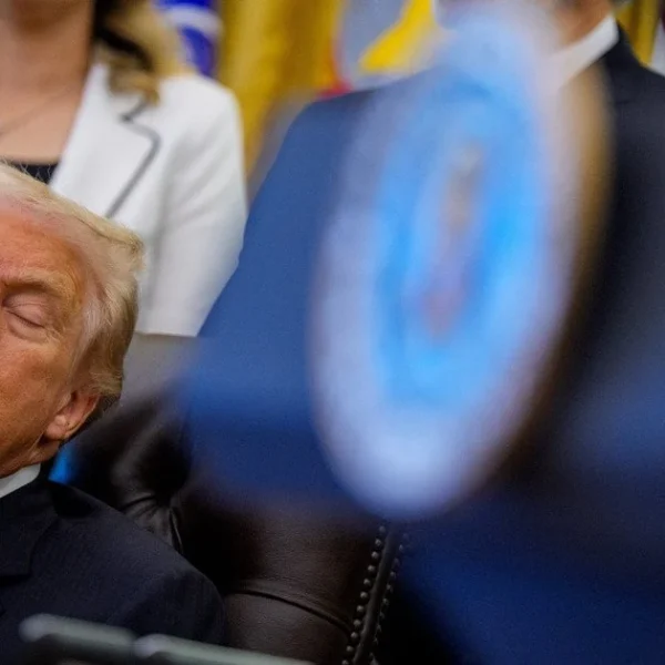 Трамп: синці, набряки та сонливість, чи справді він здоровий
