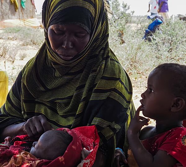 MSF: Діти-біженці в Сомалі страждають від загострення кризи недоїдання