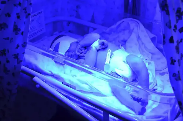 Перинатальний центр Києва забезпечує повний цикл виходжування та збереження здоров’я недоношених дітей