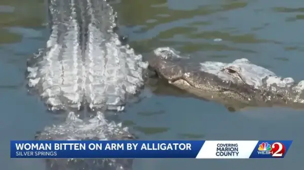 A woman is recovering at home in good spirits after suffering a traumatic right-arm amputation in an alligator attack on the Silver River in Marion County, Florida. Her family credits a quick-thinking boater with saving her life. The attack occurred Saturday August 8, 2026 while the victim and a group of swimmers were in the springs. According to the family, the woman attempted to push the alligator away with a paddle, but the alligator grabbed her by the arm and pulled her underwater. Link -https://www.youtube.com/watch?v=_QAEbqc-HGs