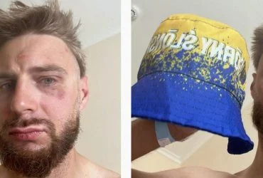 В Чехії побили поляка, якого прийняли за українця через кольори на панамці